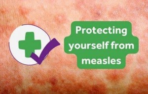 عامل مرض سرخکان چند ساعت در هوا باقی میماند و میتواند سرایت کند و باعث مریضی شود ؟